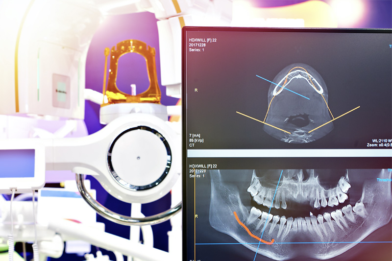 Digital X-Rays in New York